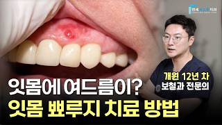 유튜브썸네일