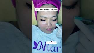 Download lagu triatment skin booster DNA salmon di Niar skin care balikpapan mp3