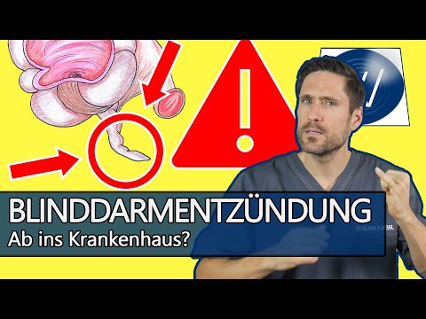 Blinddarmentzündung: Schlimme Bauchschmerzen von der Mitte bis nach rechts unten - Was jetzt tun?