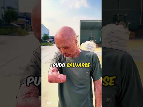 He Saved His Girlfriend But At What Price😲🥺