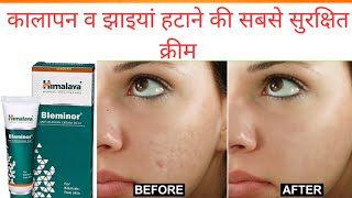Bleminor anti blemish cream review in Hindi || झाइयां हटाए रंग निखारे