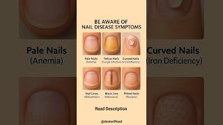 Nail Disease Warning Signs You Should Never Ignore | Nail Health Symptom Explained #healthylifestyle
