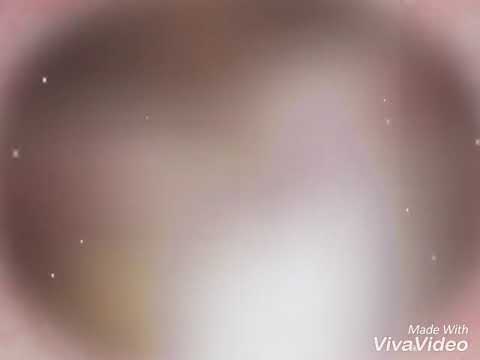 "ANDANDELE"- EL NEGRITO 01 X WILDEY X LENNY (AUDIO OFFICIAL)