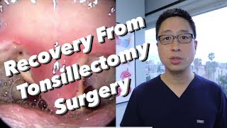 Post-Tonsillectomy Overview:  pain control, diet, bleeding concerns, physical limitations