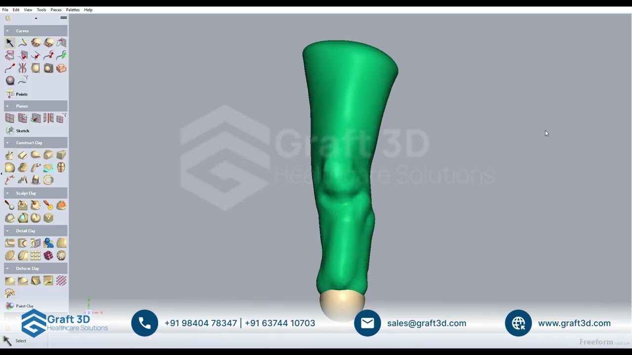 Designing  Below-Knee (Transtibial) Prosthetic Socket Using Geomagic Freeform | Graft3D P&O Workflow