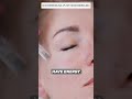 ⚡ MICRONEEDLING Vs RF MICRONEEDLING ⚡ What You Can Expect