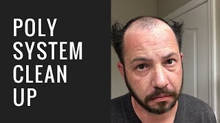 Hair Replacement Mens Hair System Review Poly System Cleanup