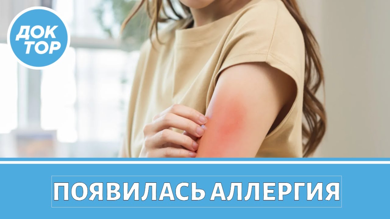 Врач–иммунолог про неочевидные причины аллергии