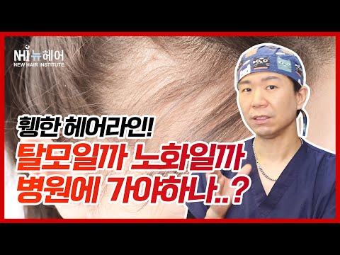 탈모인지 노화인지 구별하는 방법? l 헤어라인 l 뉴헤어