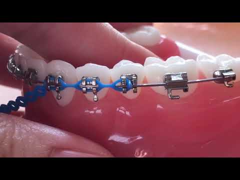 Broken powerchain with new powerchain