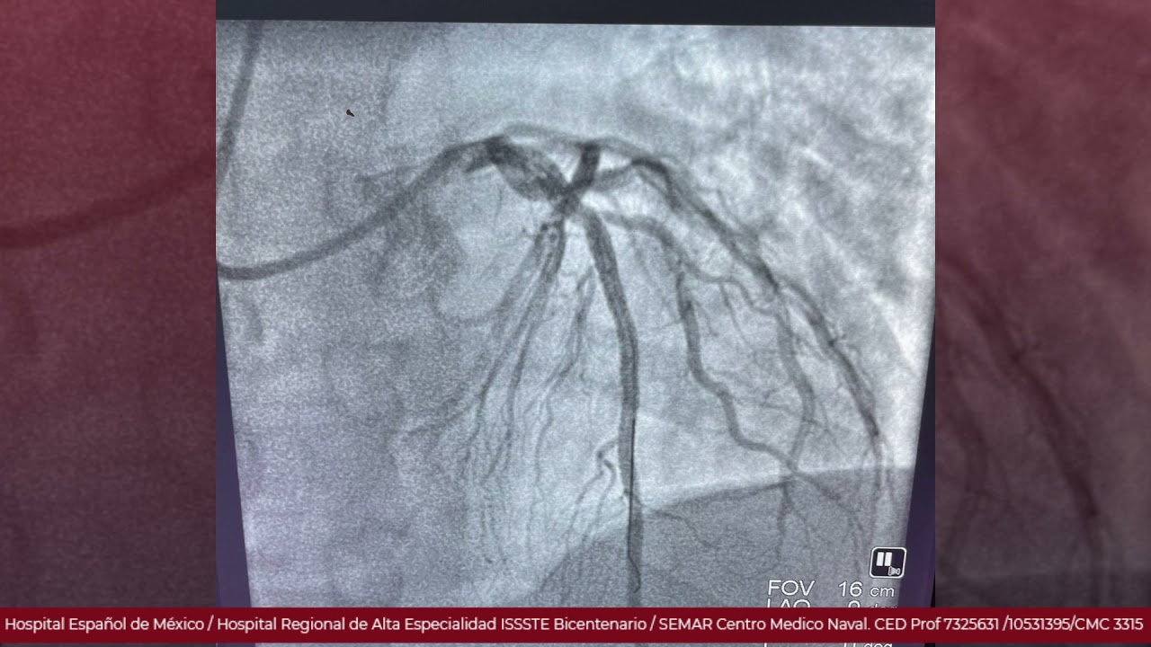Marcelo Utrera Lagunas-107