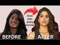 Janhvi Kapoor S Full Plastic Surgery Transformation