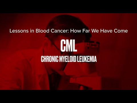 Lessons in Blood Cancer: How Far We Have Come CML