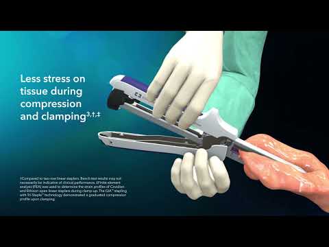 GIA™ Stapler with Tri Staple™ Technology