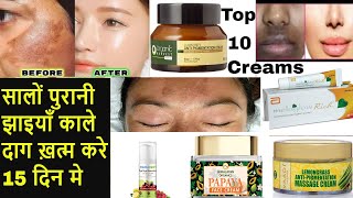 Top 10 Cream for Pigmentation on Face, Cream for Blemishes & Dark Spots,Jhaiyo ki Best Cream,Melasma