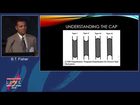 Stern D2 - CTO & Catheter Algorithm for the SFA - Dr. Bryan Fisher