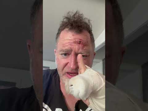 Lue Elizondo motorcycle crash recovery diary 3