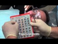 Dental Implant Surgery Help For Surgery Explicit