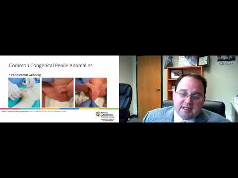 Dr  White Pediatric Urology