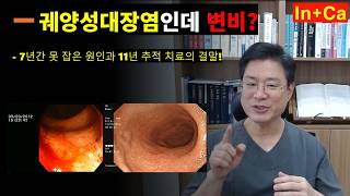 <Entity {'ja': '潰瘍性大腸炎なのに便秘？7年間突き止められなかった原因と11年の追跡治療の結末。', 'ko': '궤양성대장염인데 변비? 7년간 못 잡은 원인과 11년 추적 치료의 결말.', 'en': "Ulcerative colitis with constipation? The cause that couldn't be identified for 7 years and the conclusion of 11 years of follow-up treatment."}>