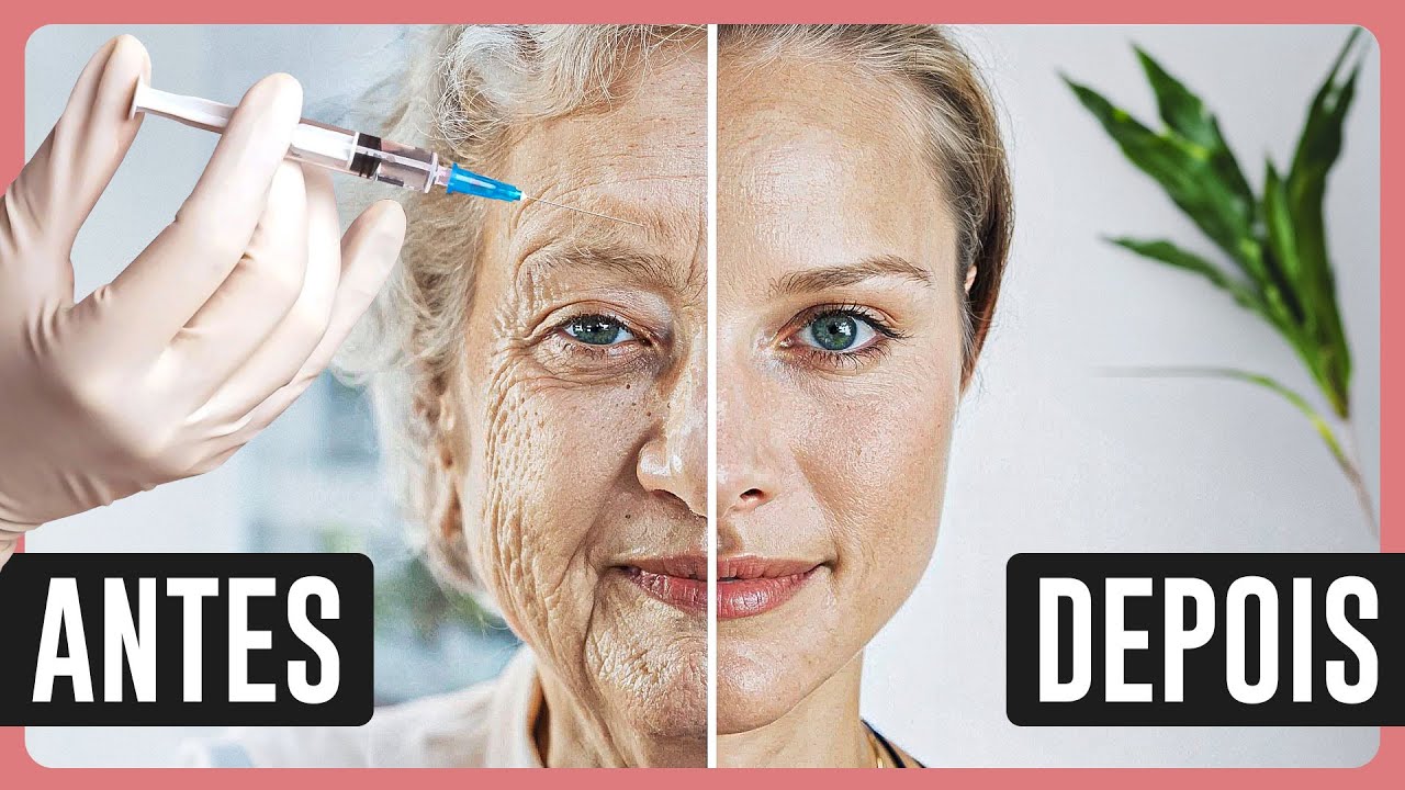 O FIM DAS RUGAS? Os MELHORES tratamentos que funcionam!