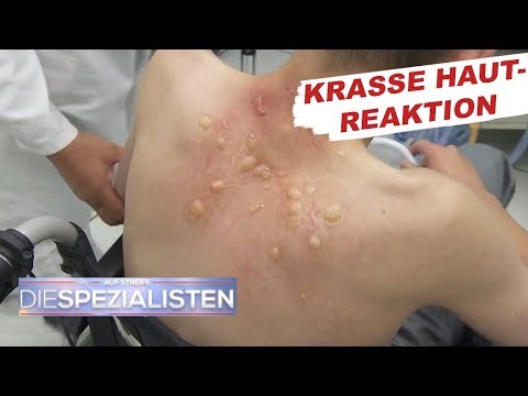 Kursk wo Röntgenstrahlen der Halswirbelsäule Was mit dem nagenden Schmerz zu tun
