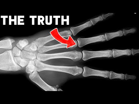 ナックルが割れることの真実 #ショートパンツ (The Truth About Cracking Your Knuckles #shorts)