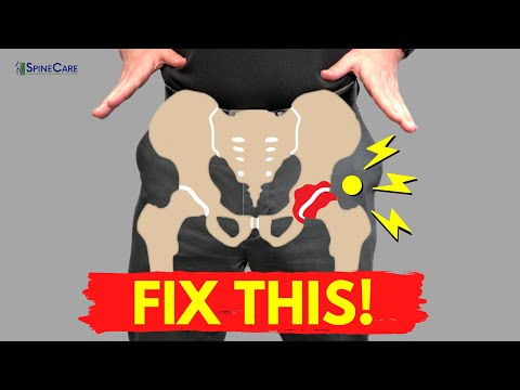 How to Fix a Popping Hip for Good (NO EQUIPMENT!)