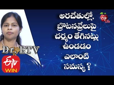 Skin Peeling on Fingertips | Fingertips Peeling | Skin Peeling on Fingers near Nails| Dry Fingertips