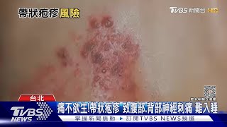 Re: [討論] 打新冠疫苗的副作用