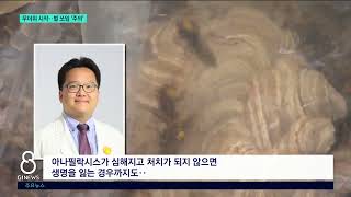 [G1뉴스]무더위 시작..벌 쏘임 주의