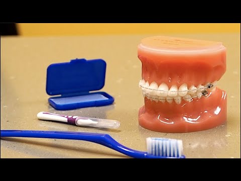 Cleaning Your Teeth And Braces