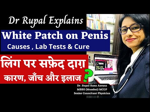 White Patch on Penis I Causes I Treatment I लिंग पर सफ़ेद दाग़ I कारण, जाँच और इलाज I Dr Rupal