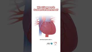 Download lagu Sudden Cardiac Death mp3