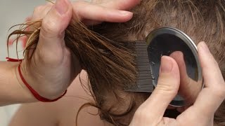 How to get rid of nits