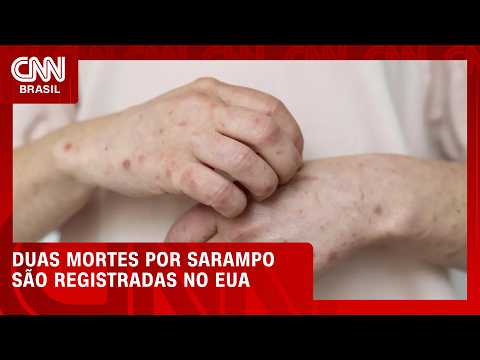 EUA registram primeiras mortes por sarampo em 2026 | CNN 360°