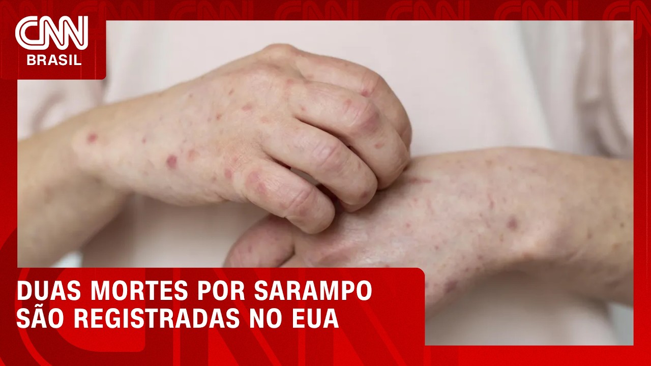 EUA registram primeiras mortes por sarampo em 2026 | CNN 360°
