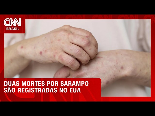 EUA registram primeiras mortes por sarampo em 2026 | CNN 360°