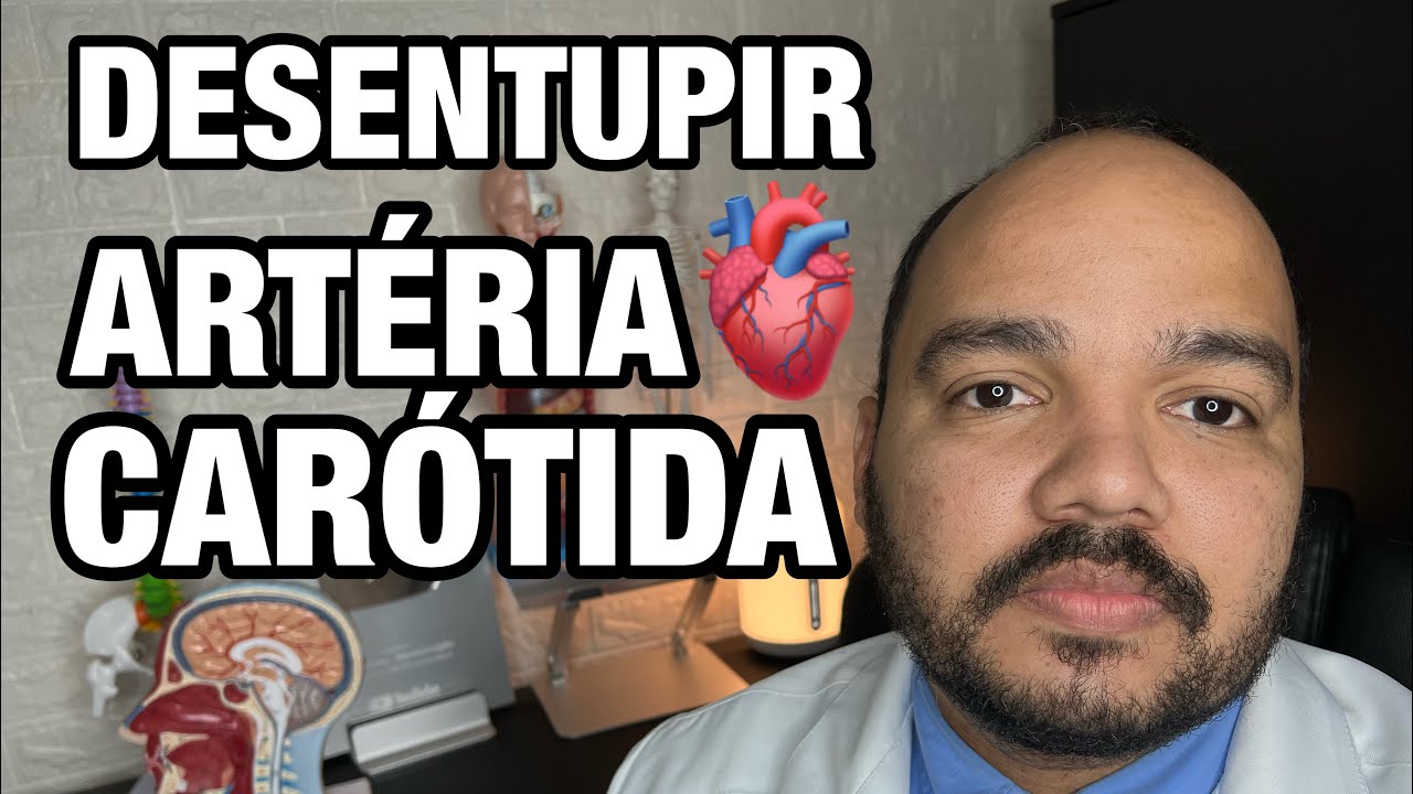 Como desentupir as "placas de gordura" (aterosclerose) que se acumulam nas CARÓTIDAS ?