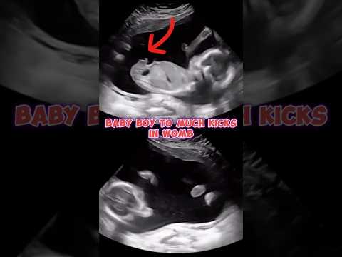 Baby boy ultrasound | Too much kicks #pregnancy #baby #babyboy #weekspregnant