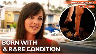 Doctors Turned Her Foot Backward to Save Her Leg | Medical Incredible