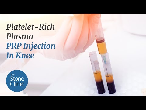 Platelet-Rich Plasma - PRP Injection In Knee for Knee Pain & Arthritis