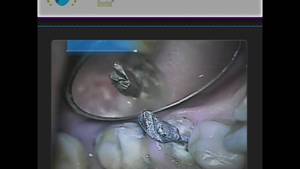 Ana Guadalupe Ontiveros Granados-7