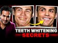 Celebrity TEETH WHITENING Secrets Revealed Whiten 20 Shades In 1 Week