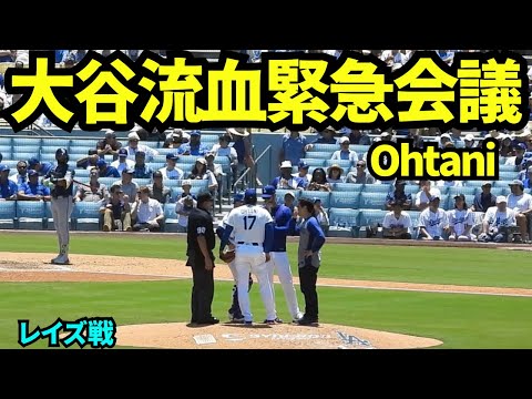 大谷翔平手の豆が潰れ流血し緊急会議! 【現地映像】2026年6月17日 ドジャースvsレイズ