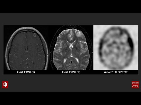 Brain Case of the Day 35