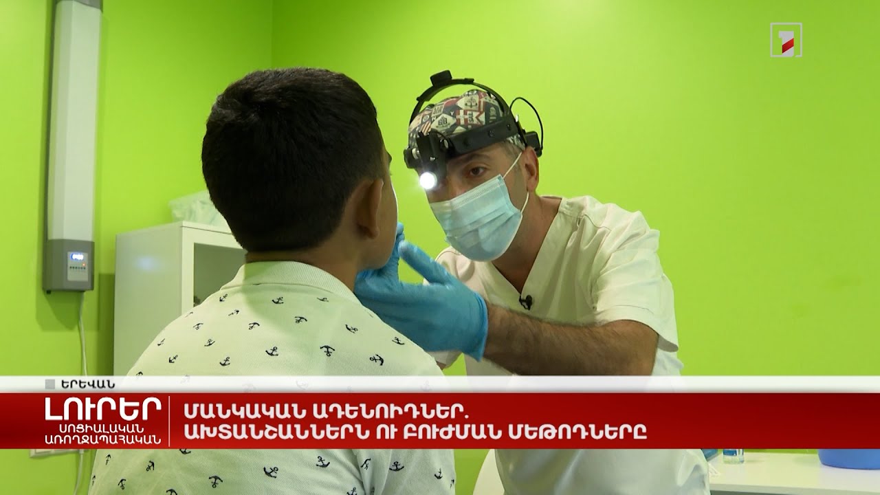 Մանկական ադենոիդներ. ախտանշաններն ու բուժման մեթոդները