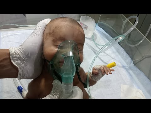 Pneumonia Baby NICU Care | Nebulizer, Suction, Warmer & Vitals Monitoring