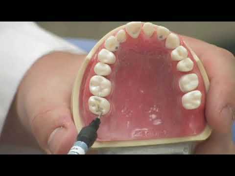 YouTube video about: How do dentists check for cavities?