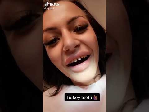 Thinking about Turkey Teeth? Think Again...